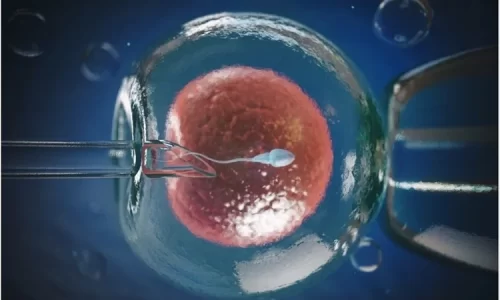 IVF ( IN Vitro Fertilization)/                                     IUI (Intrauterine insemination)